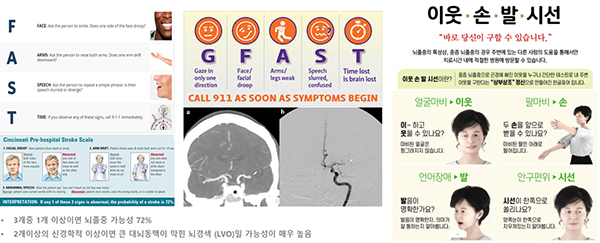 말 어눌함·마비증세 있으면 ‘뇌졸중’ 의심…“즉시 119 신고를”